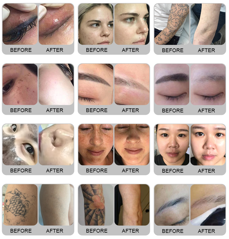 Comparison before and after treatment