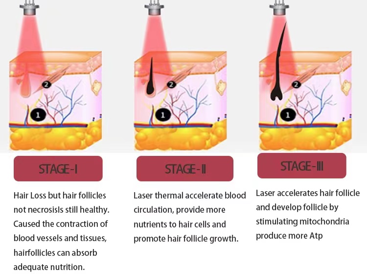 650nm hair growth machine