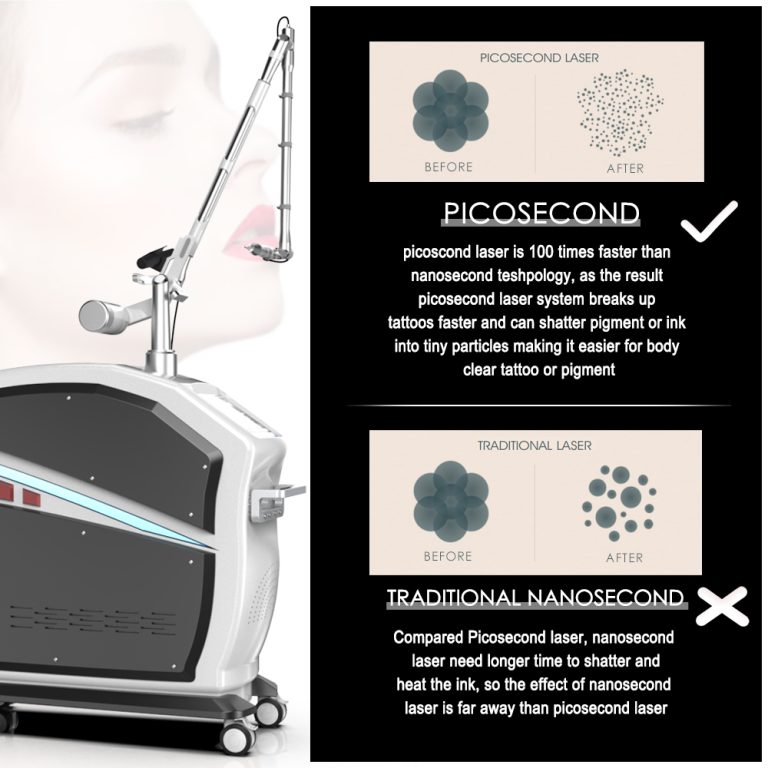 Picosecond laser machine