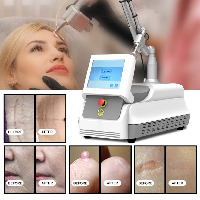 portable co2 fractional laser machine